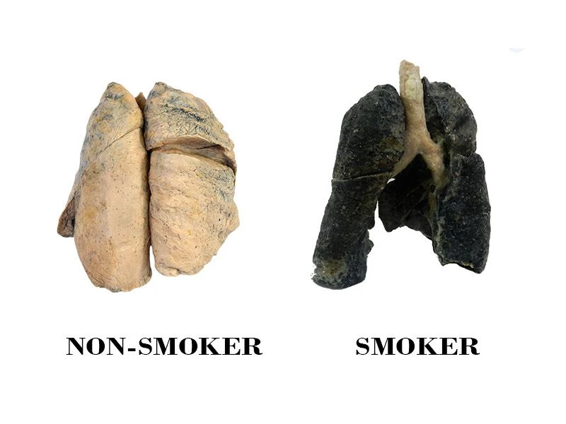 Smoker plastinated lungs